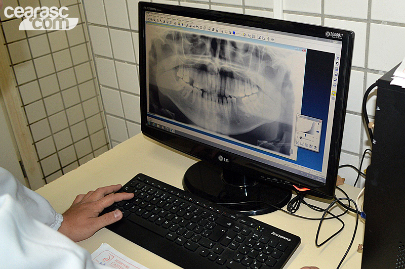 Odontologia Esportiva - 5